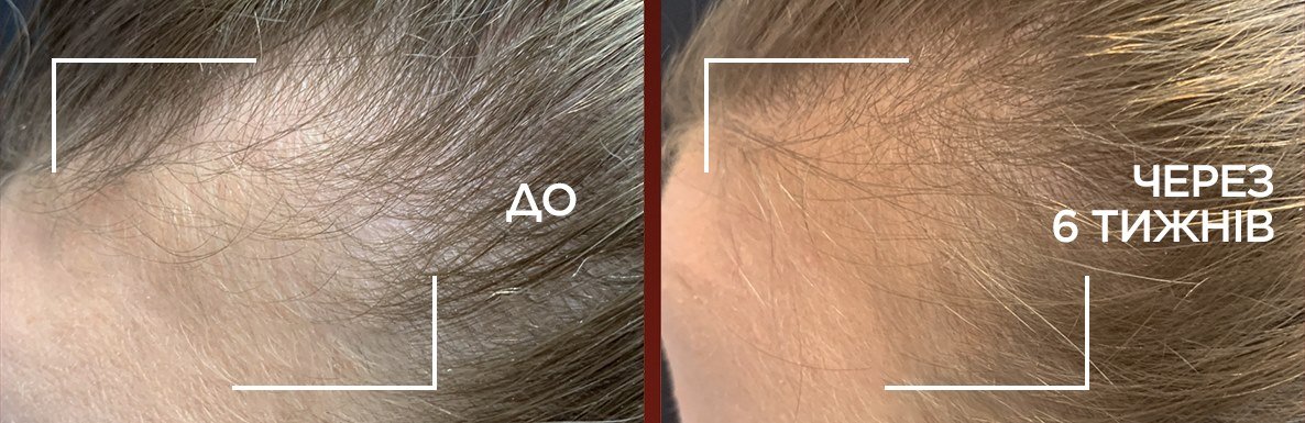 Loreal PressMix Image Www May 2024 1186x385 18